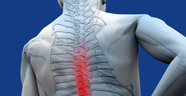 X Ray-image